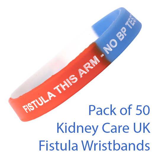 Pack of 50 Fistula Wristbands